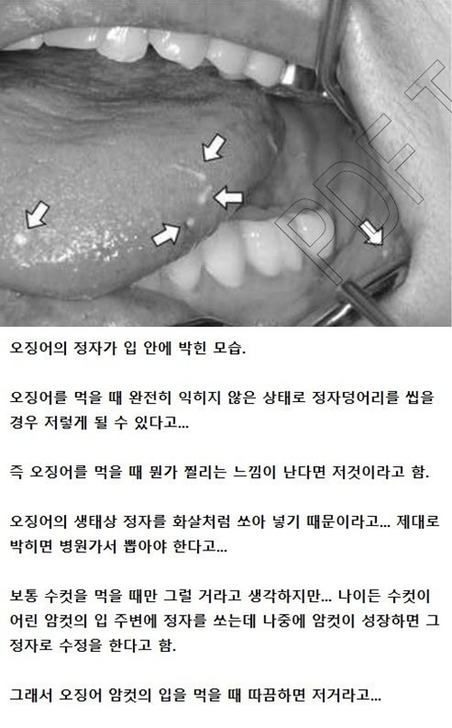 진짜 이런다고?